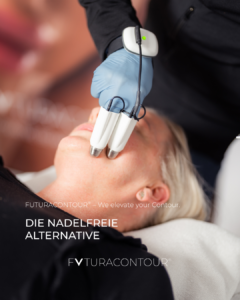 FC-Posting Behandlung FUTURACONTOUR - Behandlung