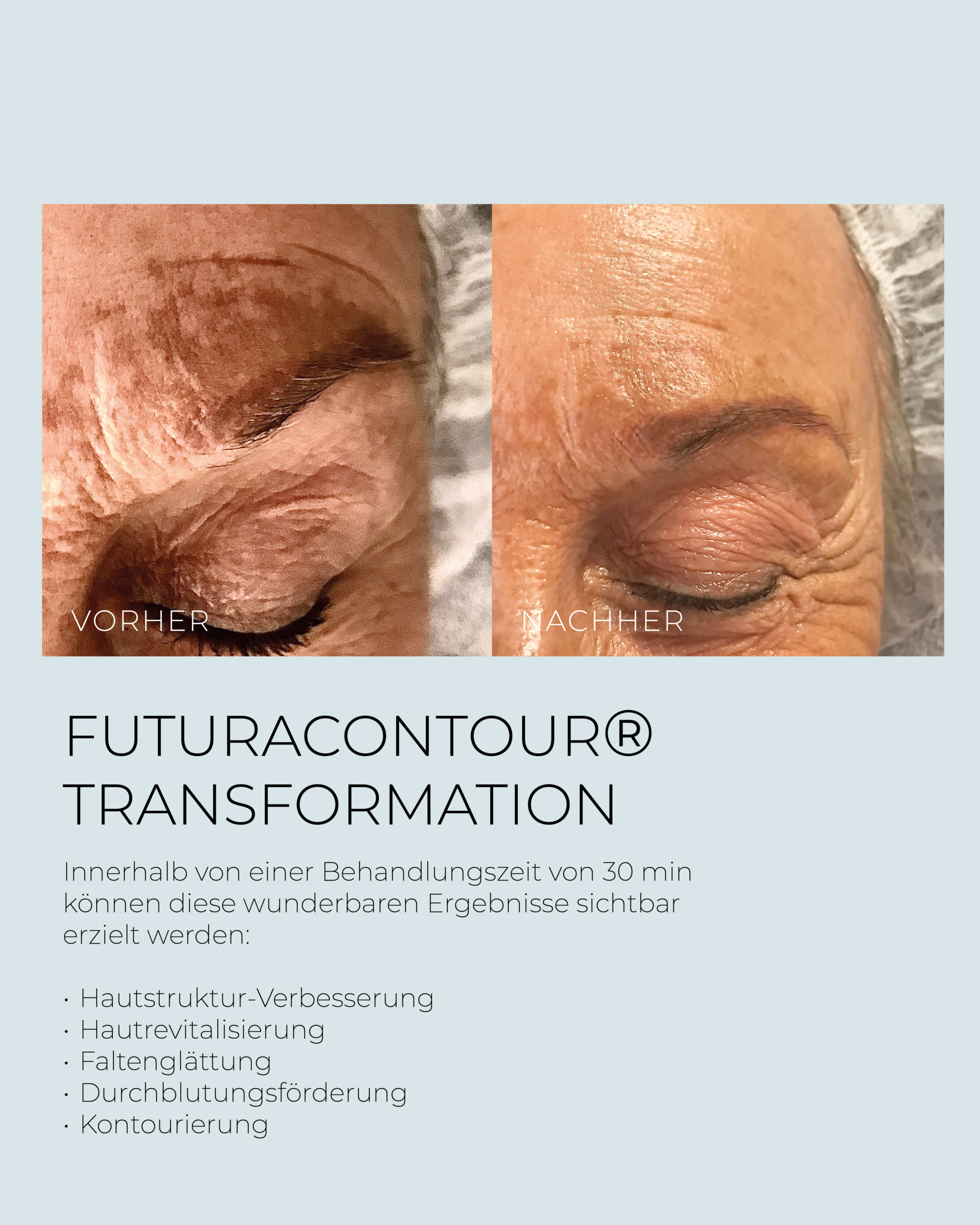 FUTURACONTOUR TRANSFORMATION